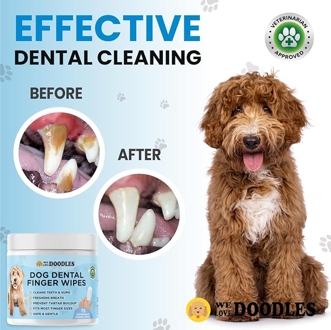 We Love Doodles Dog Teeth Cleaning Wipes - Pet Dental Finger Wipes for Dogs - Cleans Teeth and Gums, Freshens Breath Dog Dental Wipes, Prevents Tartar Buildup, Fits Most Finger Sizes (75 Wipes)